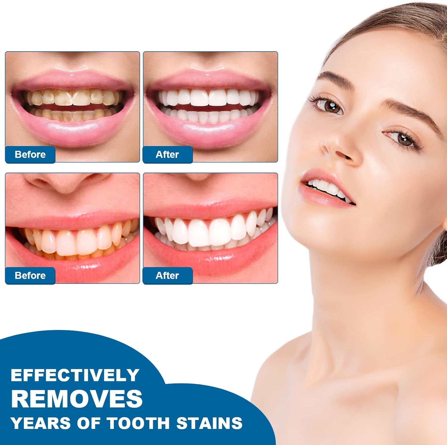 Teeth Whitening Essence Pen for Cleaning Teeth Stains, Freshening Breath and Reducing Yellowing (2Pcs)